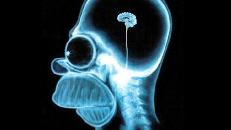 The iconic picture of Homer's Brain...
