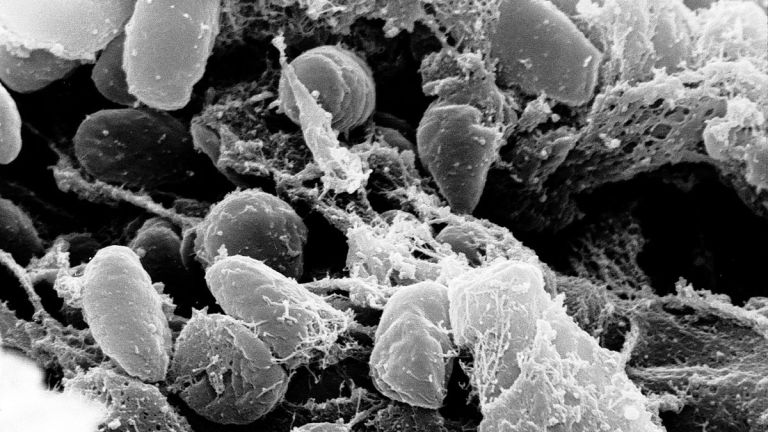 Yersinia pestis - Oldest Plague Strain