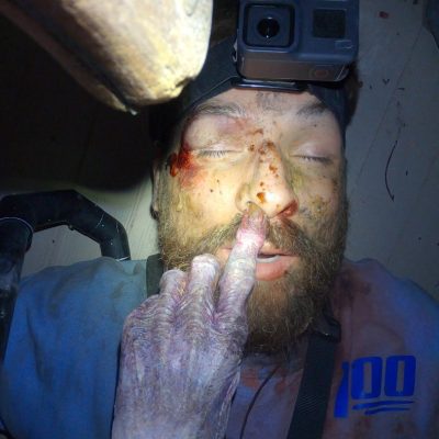 Witch picking nose in Deadstream