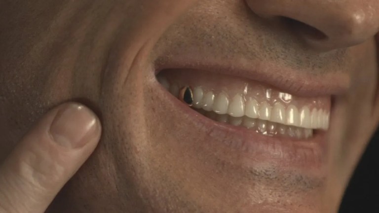 The Gold Tooth in Doctor Who